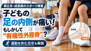 【帯広市・成長期のスポーツ障害】子どもの足の内側が痛い！有痛性外脛骨の原因と運動を休む目安
