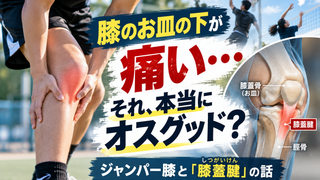 【帯広・ジャンパー膝】膝のお皿の下が痛い中高生へ｜オスグッドとの違いと「膝蓋腱」で起きていること