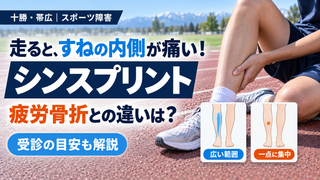 【十勝・帯広】走るとすねの内側が痛い「シンスプリント」｜疲労骨折との違いと受診の目安