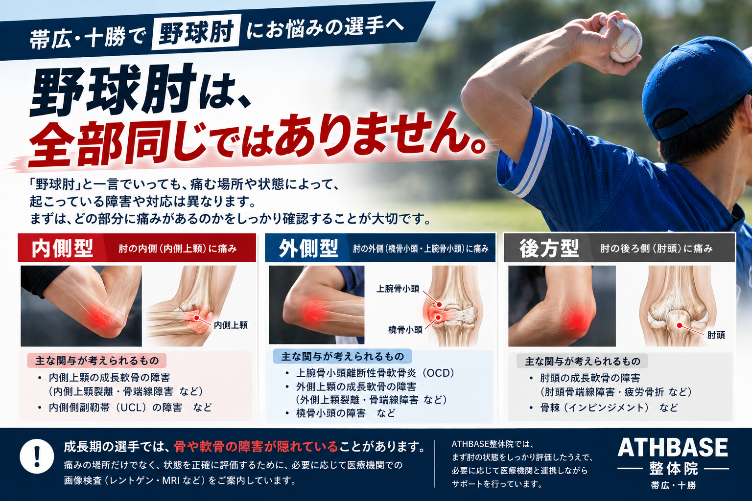 野球肘の肘の状態を確認したうえで肩 胸郭 体幹 股関節 下肢 投球動作を評価